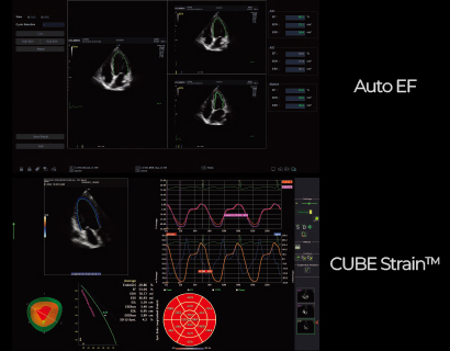 Echo Package : Auto EF, CUBE Strain™