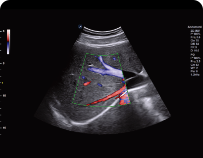 Directional PD Mode (DPDI)