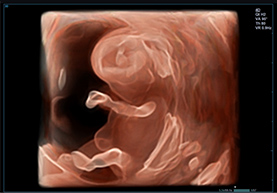 Silhouette Imaging